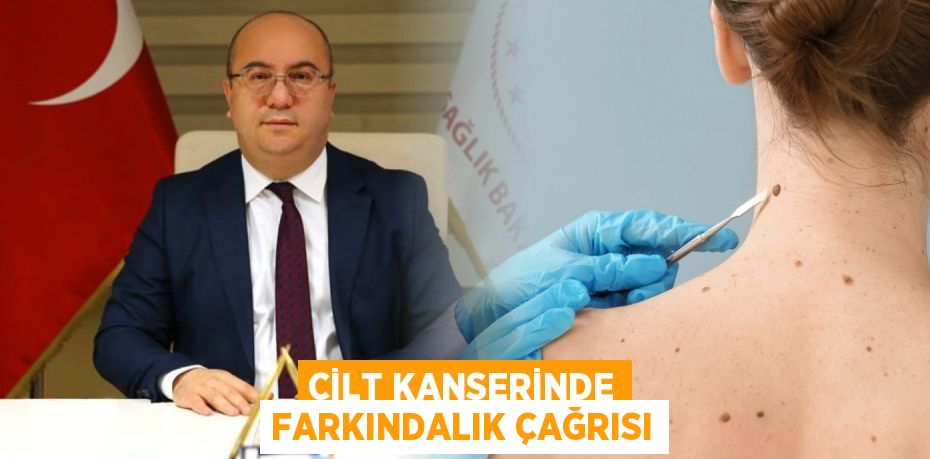 CİLT KANSERİNDE FARKINDALIK ÇAĞRISI