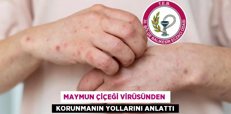 MAYMUN ÇİÇEĞİ VİRÜSÜNDEN   KORUNMANIN YOLLARINI ANLATTI