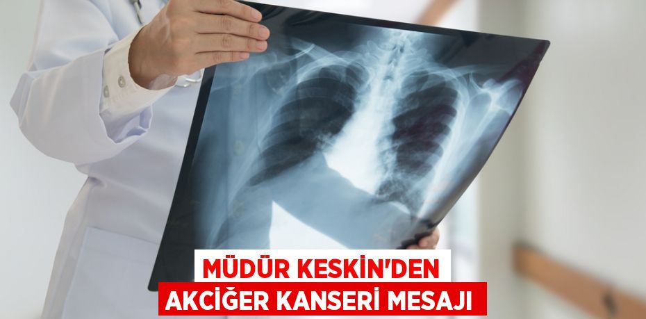 MÜDÜR KESKİN’DEN AKCİĞER KANSERİ MESAJI