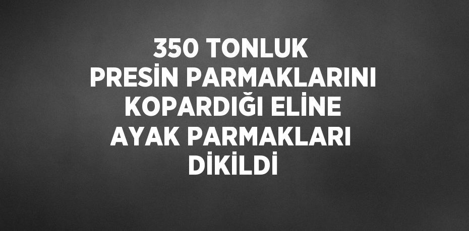 350 TONLUK PRESİN PARMAKLARINI KOPARDIĞI ELİNE AYAK PARMAKLARI DİKİLDİ