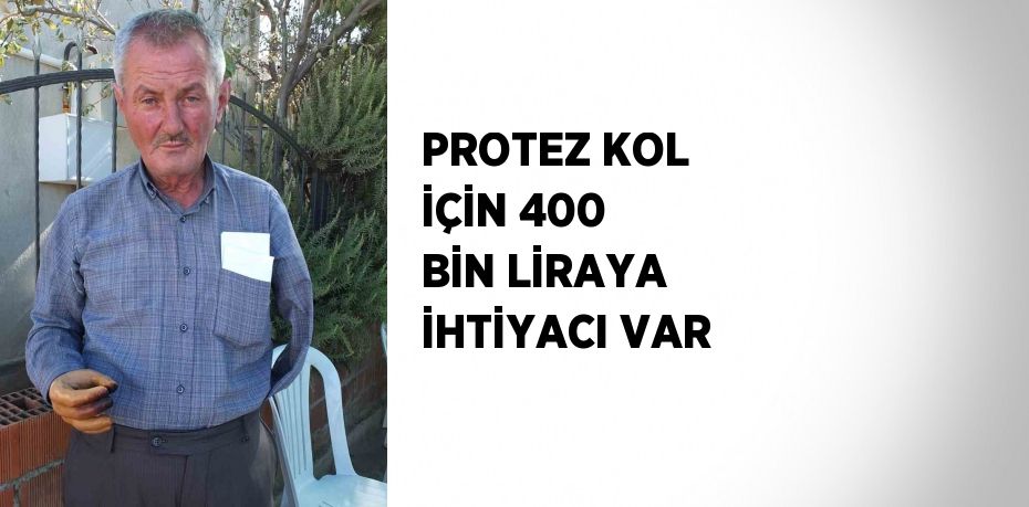 PROTEZ KOL İÇİN 400 BİN LİRAYA İHTİYACI VAR