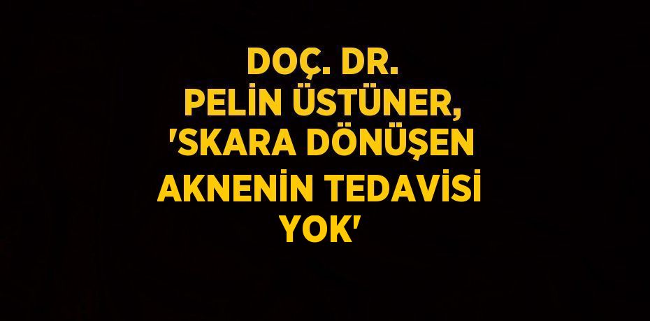 DOÇ. DR. PELİN ÜSTÜNER, 'SKARA DÖNÜŞEN AKNENİN TEDAVİSİ YOK'