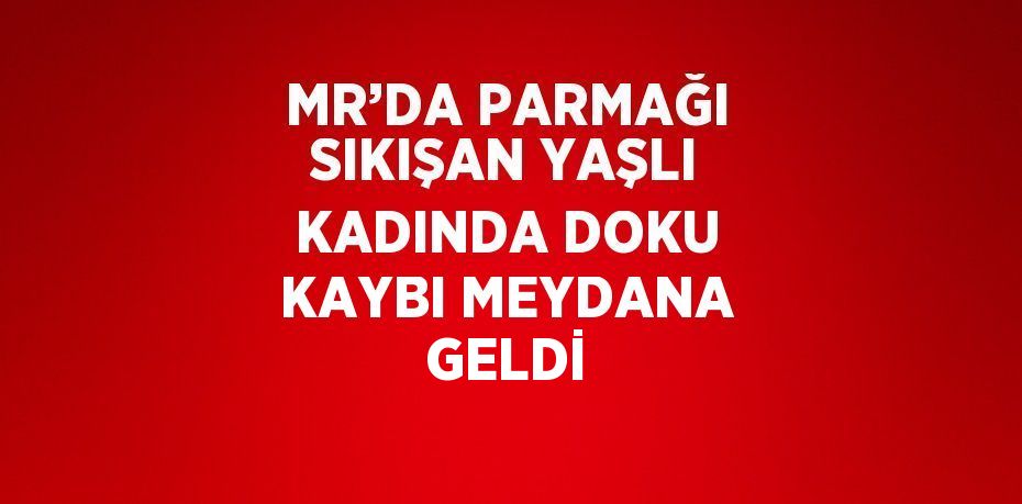 MR’DA PARMAĞI SIKIŞAN YAŞLI KADINDA DOKU KAYBI MEYDANA GELDİ