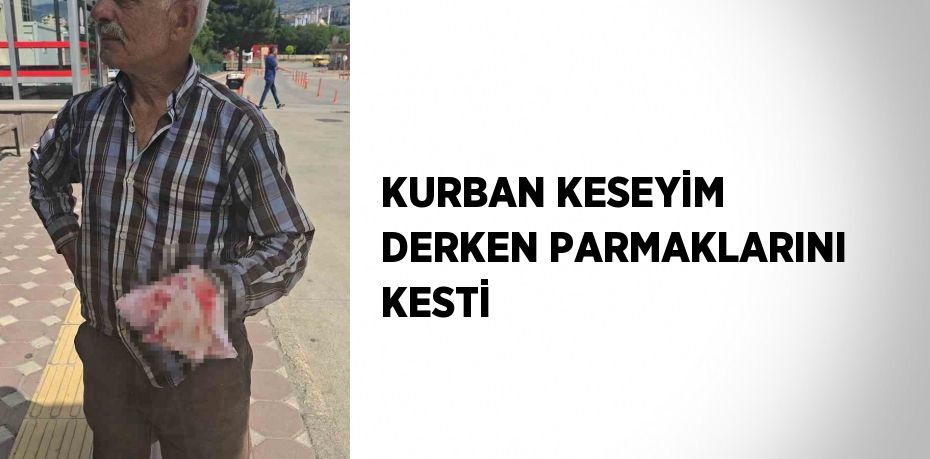 KURBAN KESEYİM DERKEN PARMAKLARINI KESTİ