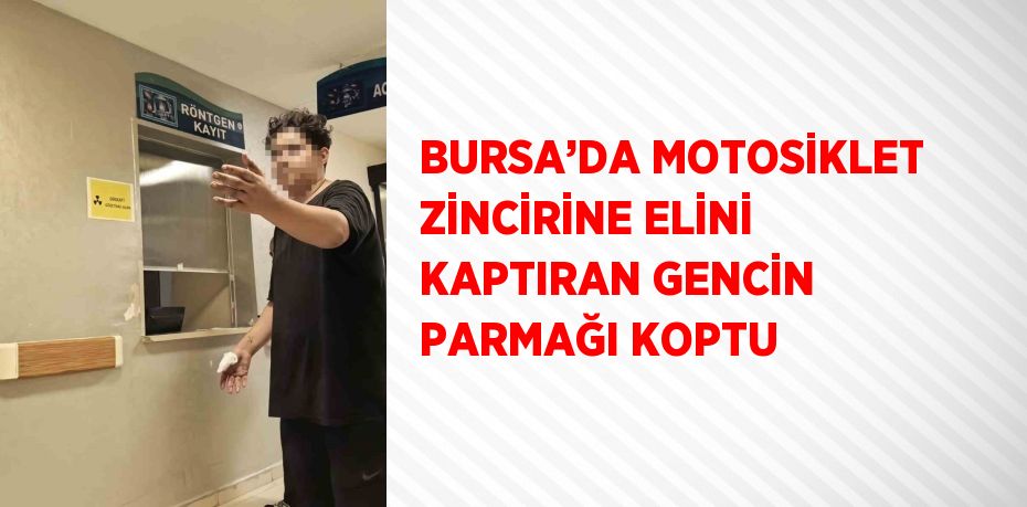 BURSA’DA MOTOSİKLET ZİNCİRİNE ELİNİ KAPTIRAN GENCİN PARMAĞI KOPTU