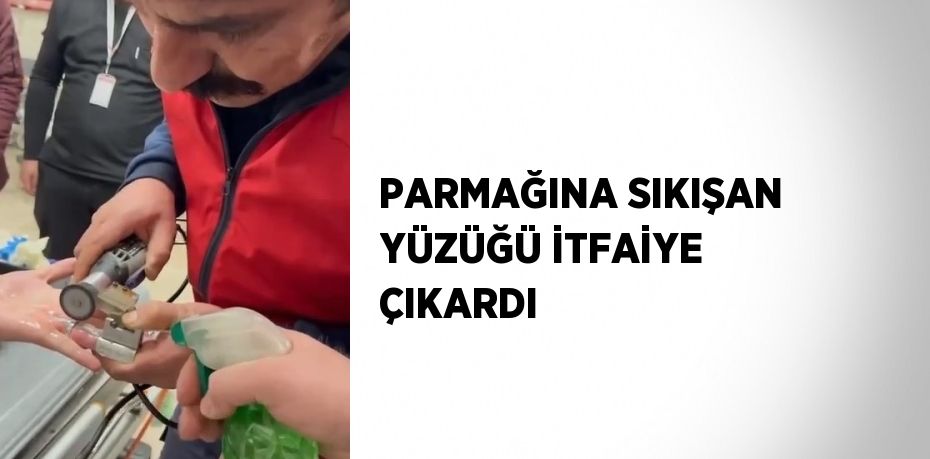 PARMAĞINA SIKIŞAN YÜZÜĞÜ İTFAİYE ÇIKARDI