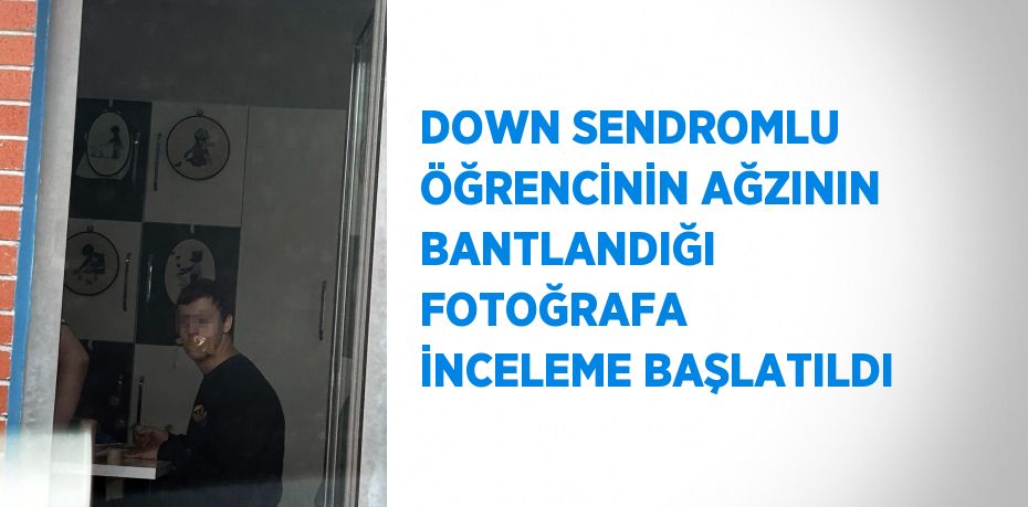 DOWN SENDROMLU ÖĞRENCİNİN AĞZININ BANTLANDIĞI FOTOĞRAFA İNCELEME BAŞLATILDI