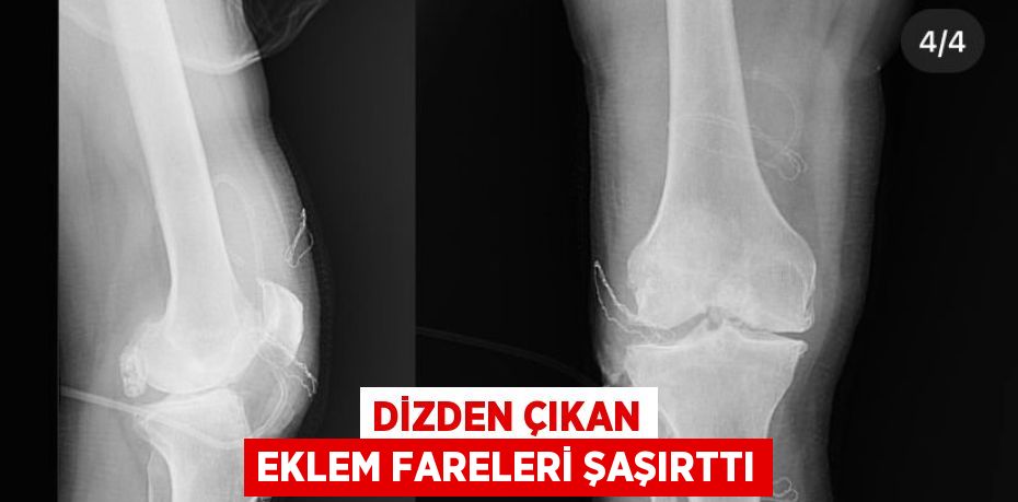 DİZDEN ÇIKAN EKLEM FARELERİ ŞAŞIRTTI