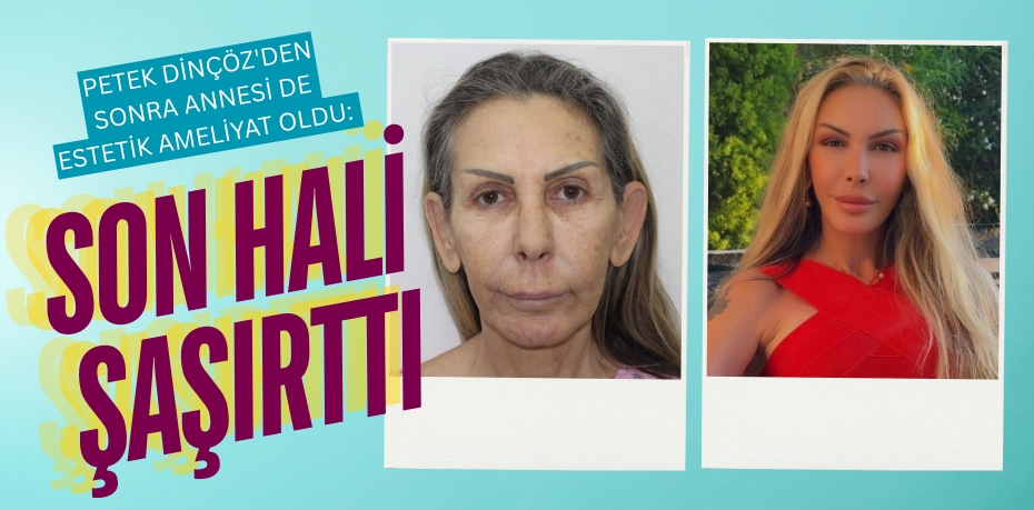 PETEK DİNÇÖZ'DEN SONRA ANNESİ DE ESTETİK AMELİYAT OLDU: SON HALİ ŞAŞIRTTI