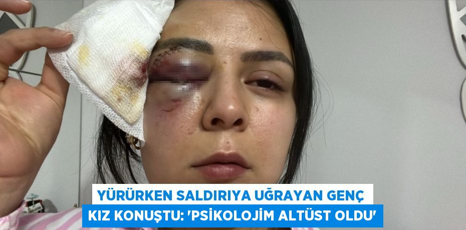 YÜRÜRKEN SALDIRIYA UĞRAYAN GENÇ KIZ KONUŞTU: 'PSİKOLOJİM ALTÜST OLDU'