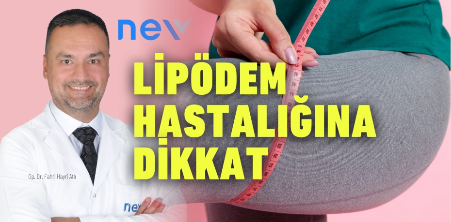 LİPÖDEM HASTALIĞINA DİKKAT