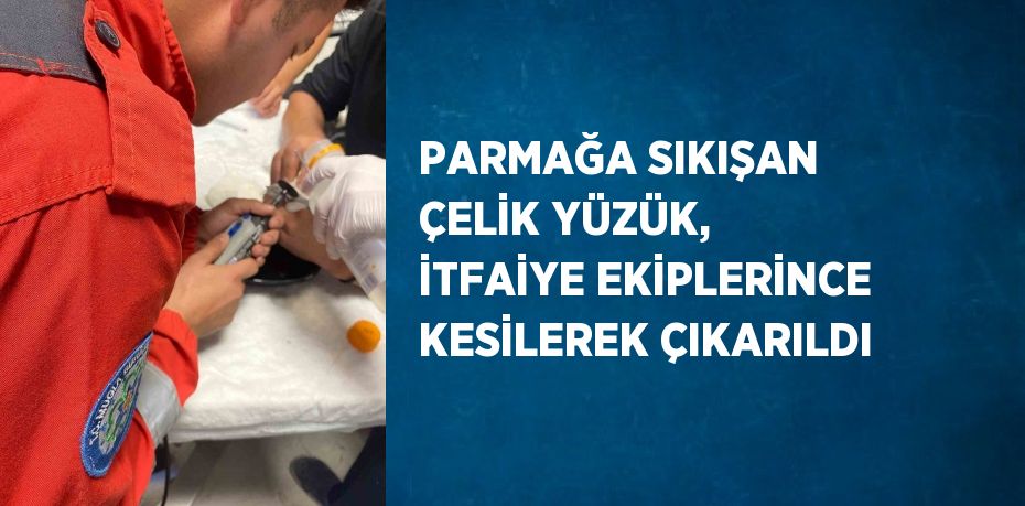 PARMAĞA SIKIŞAN ÇELİK YÜZÜK, İTFAİYE EKİPLERİNCE KESİLEREK ÇIKARILDI