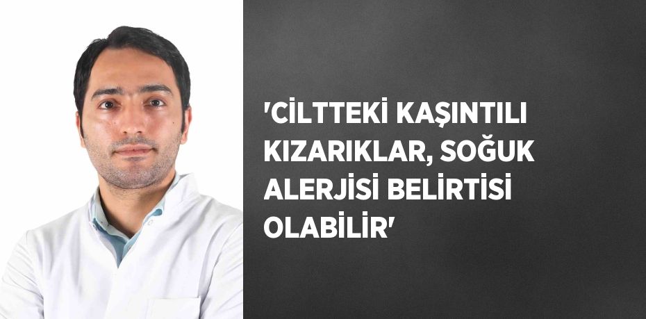 'CİLTTEKİ KAŞINTILI KIZARIKLAR, SOĞUK ALERJİSİ BELİRTİSİ OLABİLİR'