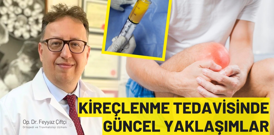 KİREÇLENME TEDAVİSİNDE GÜNCEL YAKLAŞIMLAR