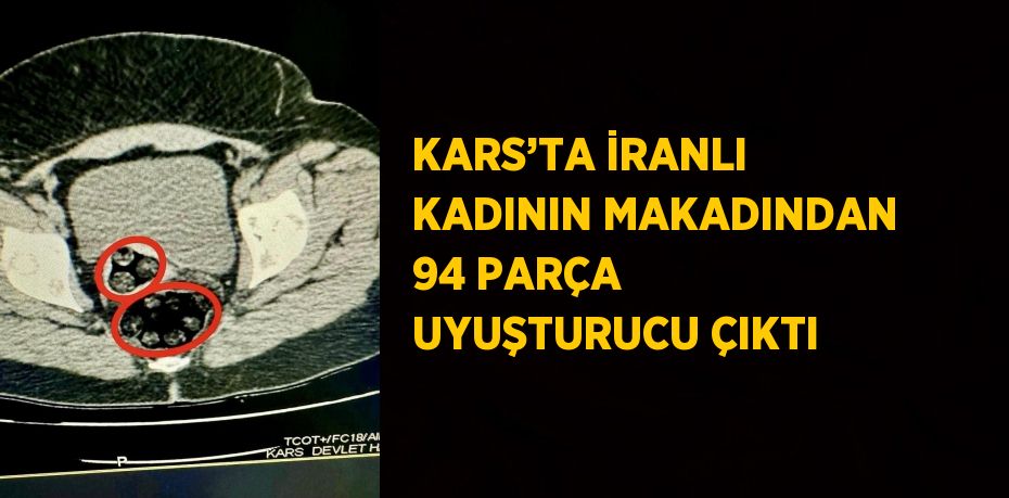 KARS’TA İRANLI KADININ MAKADINDAN 94 PARÇA UYUŞTURUCU ÇIKTI