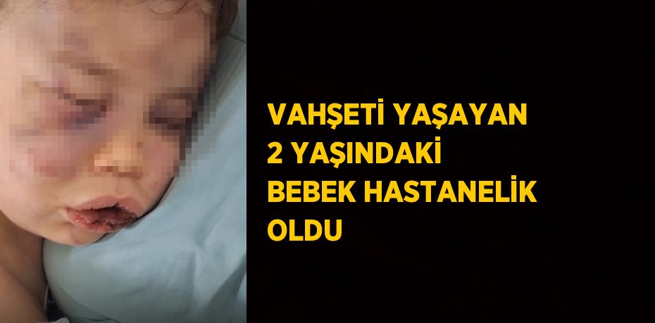 VAHŞETİ YAŞAYAN 2 YAŞINDAKİ BEBEK HASTANELİK OLDU