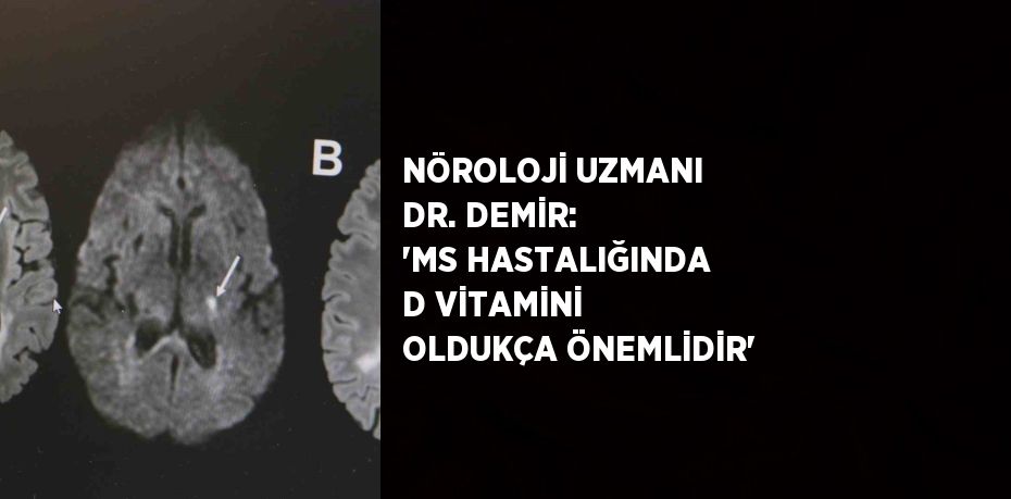 NÖROLOJİ UZMANI DR. DEMİR: 'MS HASTALIĞINDA D VİTAMİNİ OLDUKÇA ÖNEMLİDİR'