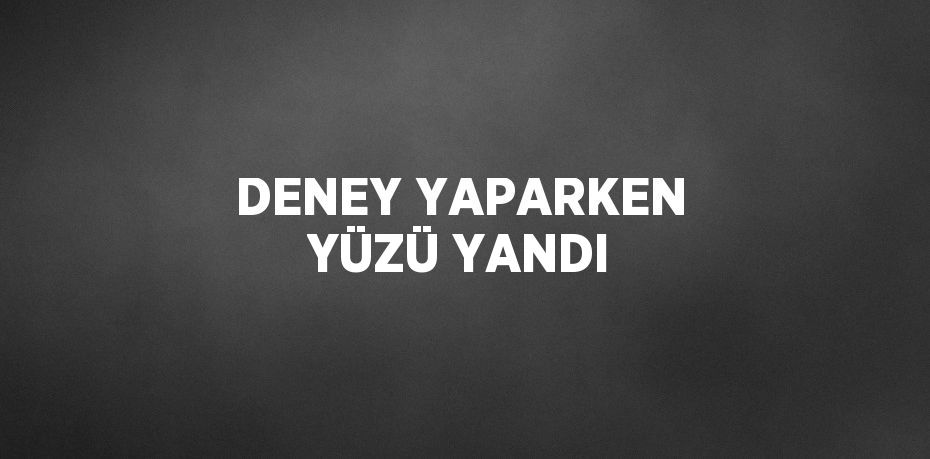 DENEY YAPARKEN YÜZÜ YANDI