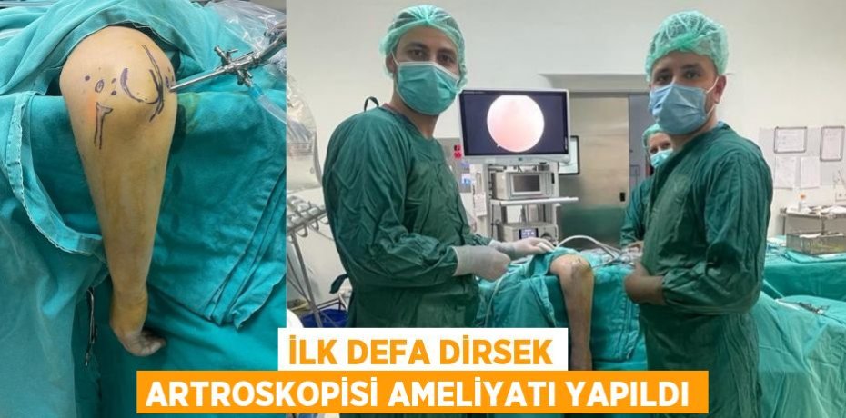 İLK DEFA DİRSEK ARTROSKOPİSİ AMELİYATI YAPILDI