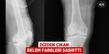 20435258522992927380tasarimli