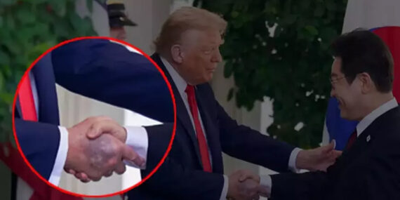 Trump’ın elindeki morluk hakkında Beyaz Saray’dan açıklama