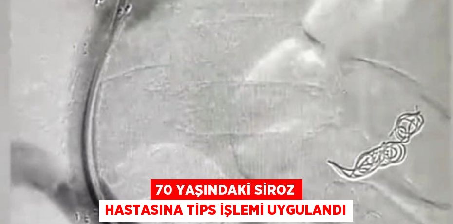 30568293592308723184tasarimli