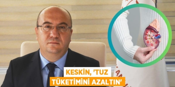KESKİN, “TUZ TÜKETİMİNİ AZALTIN”