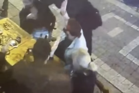 Kadıköy’de dehşet anlarının görüntüsü ortaya çıktı... Genç kadının yüzünü böyle yaktı