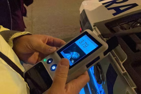 Kaza sonrası 3.79 promil alkollü çıkan elektrikli bisiklet sürücüsü, "Çirkin çıkmışım" dedi